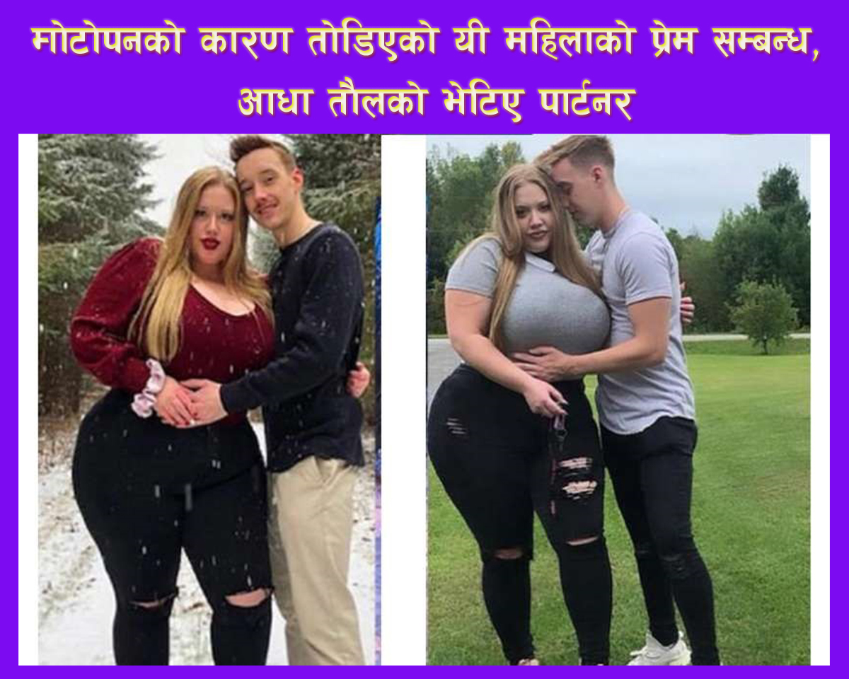 मोटोपनको कारण तोडिएको यी महिलाको प्रेम सम्बन्ध, आधा तौलको भेटिए पार्टनर