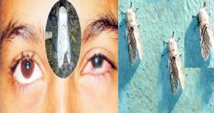 सेतो पुतलीका कारण आखाँको ज्योति गुम्न सक्ने भन्दै गुल्मी प्रशासनले गर्यो सर्तक रहन आग्रह