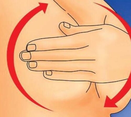 महिलाहरूको निःशुल्क क्यान्सर परीक्षण सुरु