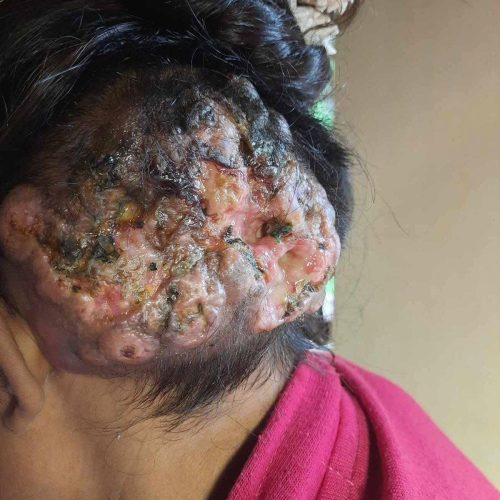 गण्डकी गाउँपालिकाको सुत्केरी महिला: सहयोग र स्वास्थ्य सेवाको कथा