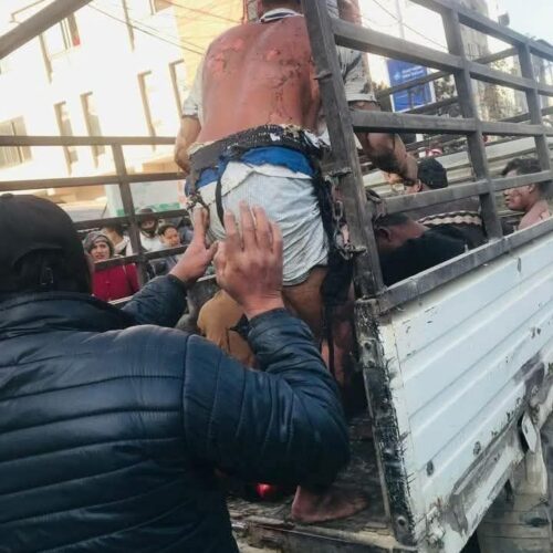 बैलुन काण्ड: समानताको प्रश्न र जनताको पीडा