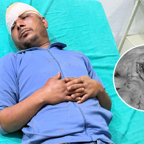 बैतडीमा एमाले र रास्वपाका कार्यकर्ताबीच झडप, ३ जना घाइते